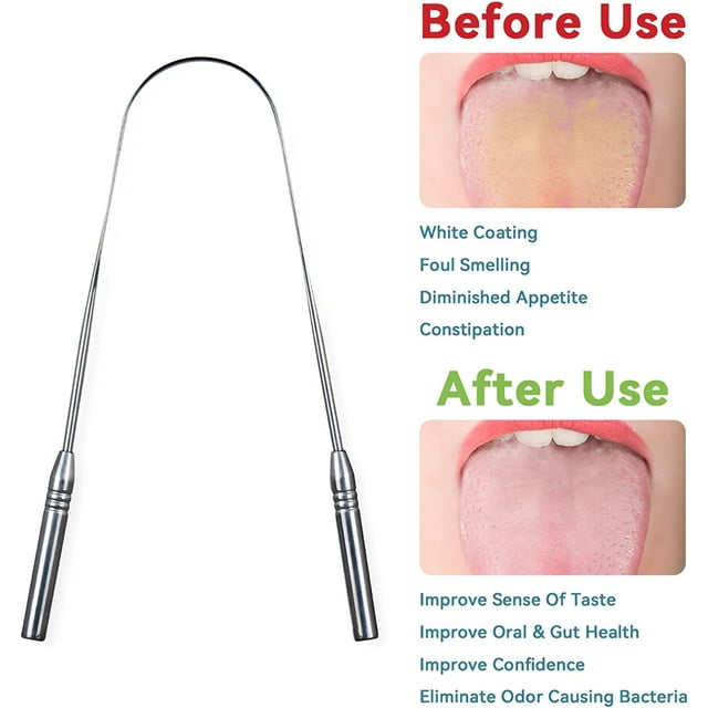 Mitimi Tongue Scraper with Case - 2 Pack, Fights Bad Breath, 100% Stainless Steel