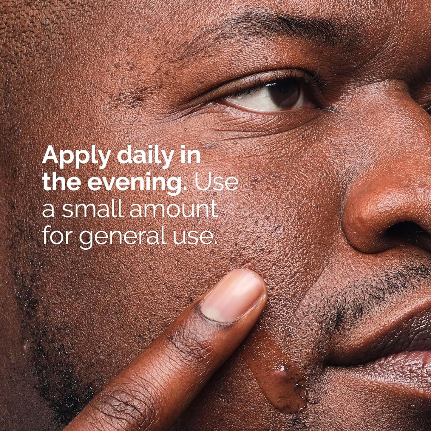 The Ordinary Salicylic Acid 2% Solution, Acne-Fighting Serum for Blemish-Prone Skin